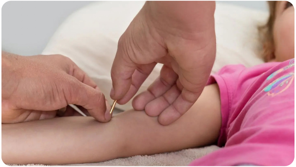 Pediatric Acupuncture at Embody Health and Performance with Andrea Cyr